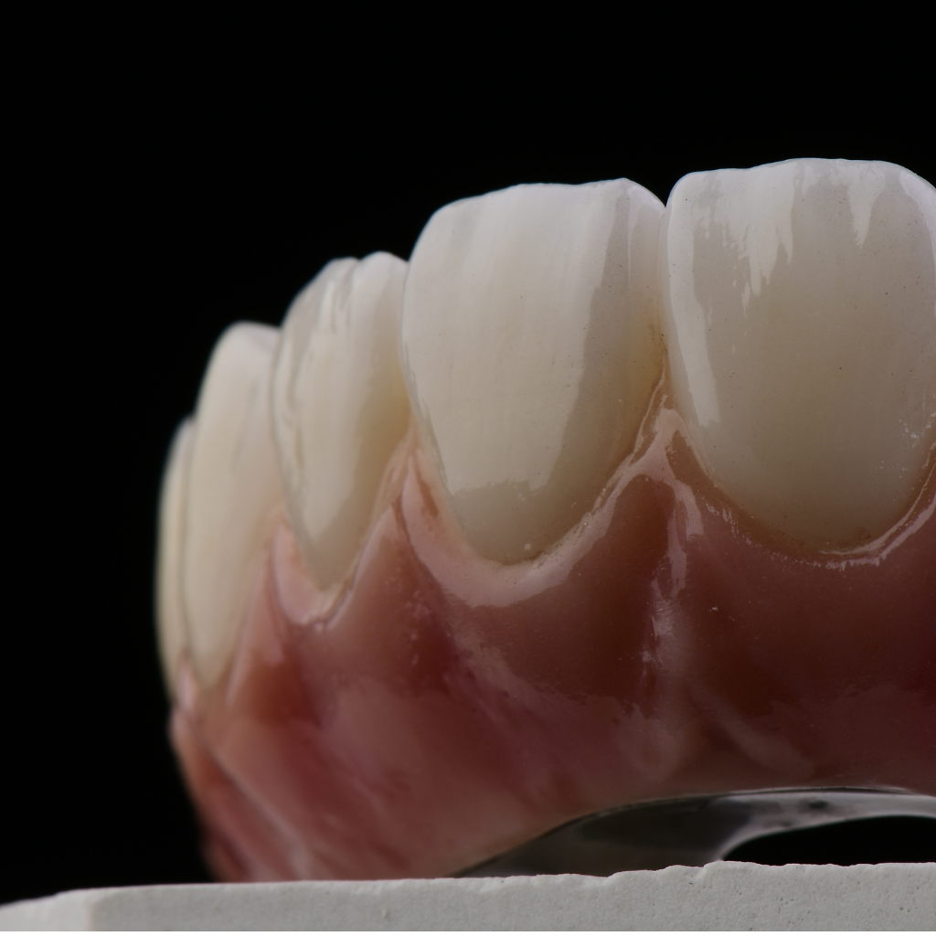 Korony cyrkonowe — widok z przodu