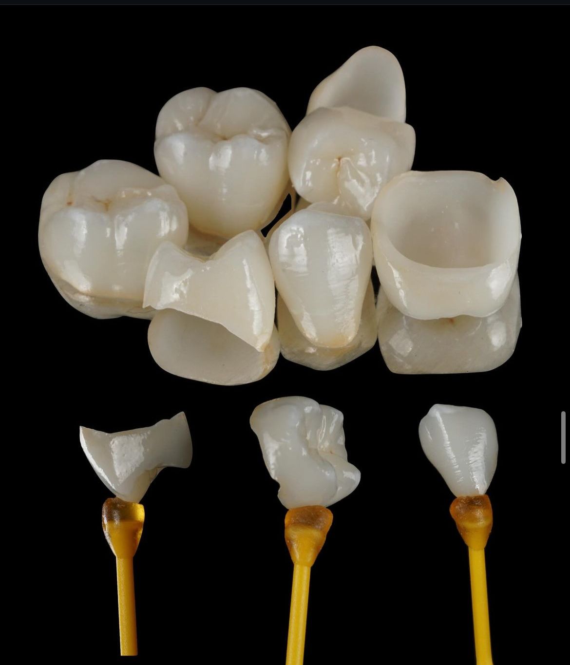 Odbudowa estetyczna — szczegół