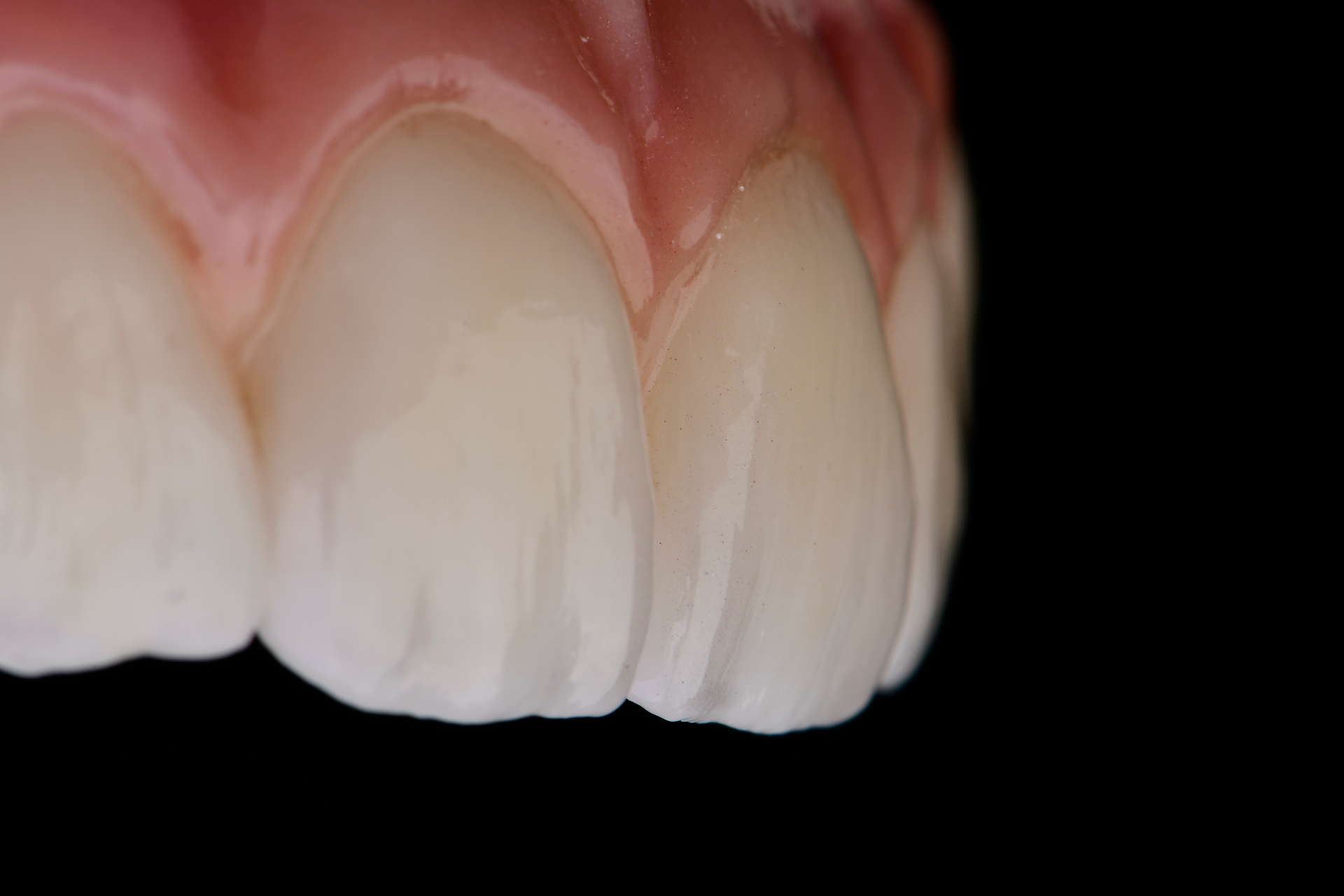 Ząb w naturalnym środowisku — filozofia biomimetyki